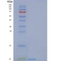 人FDCSP重组蛋白