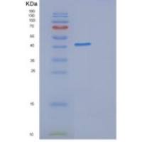 人半乳糖-1-磷酸尿苷酰转移酶(GALT)重组蛋白