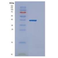 小鼠Gapth重组蛋白