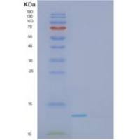 人甘丙肽(GAL)重组蛋白