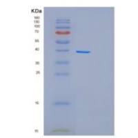 人果糖-1.6-二磷酸酶1重组蛋白