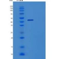 人成纤维细胞生长因子内结合蛋白(FIBP)重组蛋白