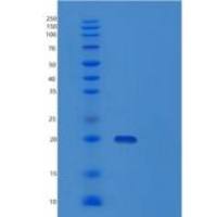小鼠成纤维细胞生长因子21(FGF21)重组蛋白