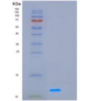 人GCHFR重组蛋白