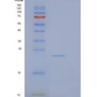 人GCET2重组蛋白