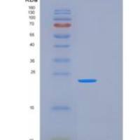 人FTSJ2重组蛋白