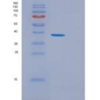 人GGPS1重组蛋白