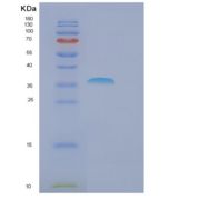 人FBXO6重组蛋白产品图