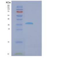 人FBXO6重组蛋白