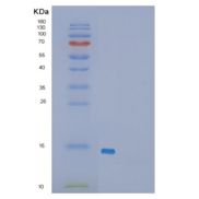 人FK506结合蛋白2(FKBP2)重组蛋白