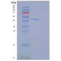 人丝蛋白结合LIM蛋白1(FBLIM1)重组蛋白