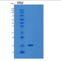 人碱性成纤维细胞生长因子(FGF2)重组蛋白