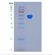 人FK506结合蛋白4(FKBP4)重组蛋白