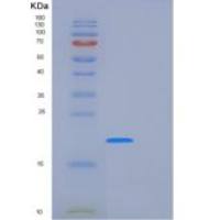 人远端上游元件结合蛋白1(FUBP1)重组蛋白