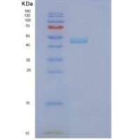 人苯丙氨酰tRNA合成酶2(FARS2)重组蛋白