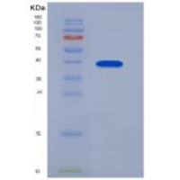 人半乳糖凝集素9(GAL9)重组蛋白