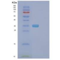 人法尼基二磷酸法尼基转移酶1(FDFT1)重组蛋白