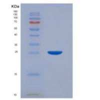 人果糖-1,6-二磷酸酶2(FBP2)重组蛋白