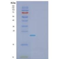 人成纤维细胞生长因子10(FGF10)重组蛋白