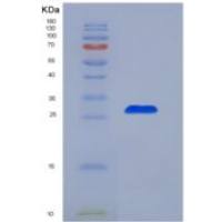 人非ATP酶蛋白酶体26S亚基10(PSMD10)重组蛋白