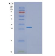 人EXOSC5重组蛋白