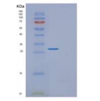 人EXOSC5重组蛋白
