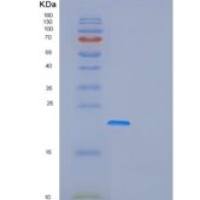 人FOPNL重组蛋白