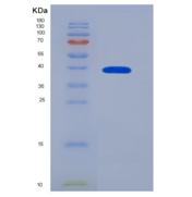 人半乳糖凝集素9(GAL9)重组蛋白