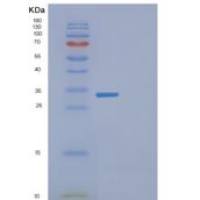 人EXOSC8重组蛋白