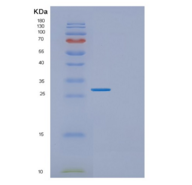 人EXOSC5重组蛋白