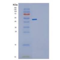 人GDP解离抑制因子1(GDI1)重组蛋白