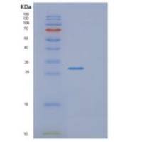 人外切酶体成分4(EXOSC4)重组蛋白
