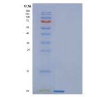 人FANK1重组蛋白