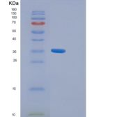 人γ-谷氨酰水解酶(gGH)重组蛋白