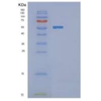 人葡萄糖脑苷脂酶(GBA)重组蛋白