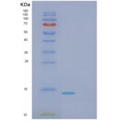 人FK506结合蛋白1B(FKBP1B)重组蛋白