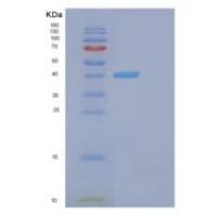 人纤维蛋白原β(FGB)重组蛋白