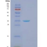 人F-框蛋白2(FBXO2)重组蛋白