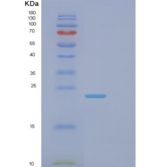 人IgG-Fc片段低亲和力受体Ⅱb(FcgR2B)重组蛋白