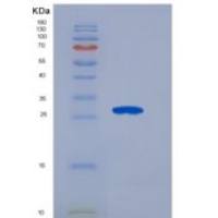 人成纤维细胞生长因子21(FGF21)重组蛋白