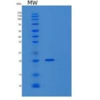 人GADD153重组蛋白