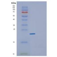 人GEMIN6重组蛋白