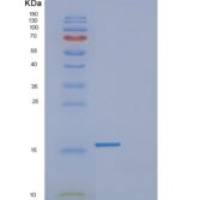 人脂肪酸结合蛋白1(FABP1)重组蛋白