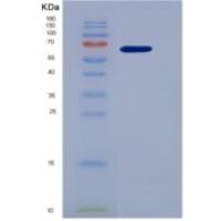 人联会蛋白(GMNN)重组蛋白
