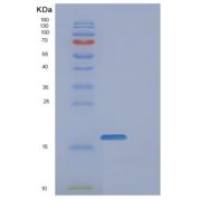 人FAM107B重组蛋白