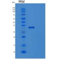人半乳糖凝集素4(GAL4)重组蛋白