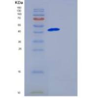 人GALK1重组蛋白