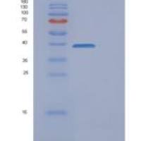 人FAM49B重组蛋白