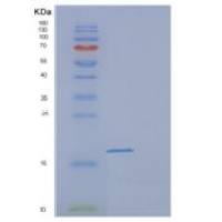 人睾丸型脂肪酸结合蛋白(FABP9)重组蛋白