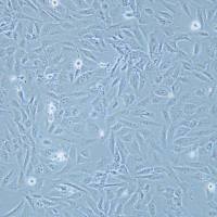 AC16/GES-1/1640培养基/dmem培养基/STR鉴定